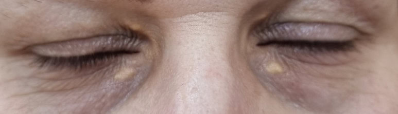Before image