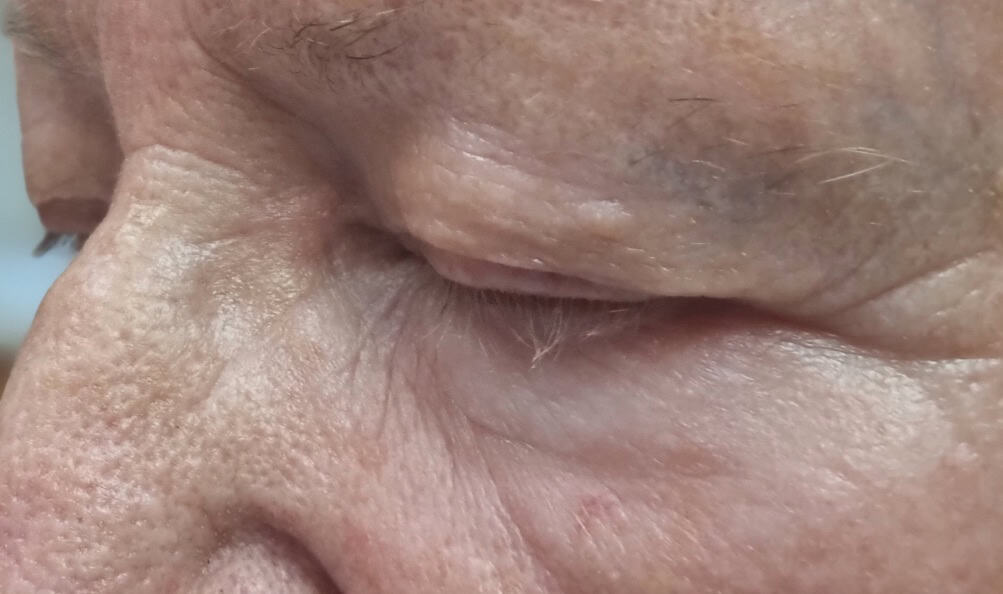 After image